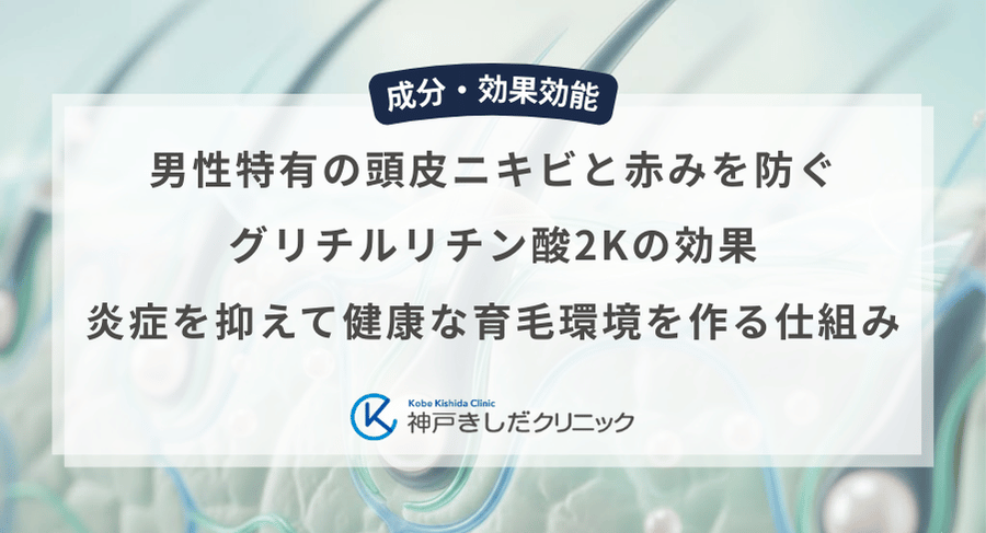 男性特有の頭皮ニキビと赤みを防ぐグリチルリチン酸2Kの効果|炎症を抑えて健康な育毛環境を作る仕組み
