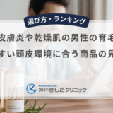 脂漏性皮膚炎や乾燥肌の男性の育毛剤選び｜荒れやすい頭皮環境に合う商品の見極め方