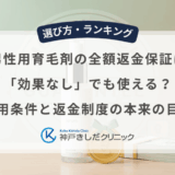 男性用育毛剤の全額返金保証は「効果なし」でも使える？適用条件と返金制度の本来の目的