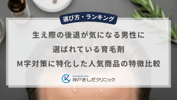 生え際の後退が気になる男性に選ばれている育毛剤｜M字対策に特化した人気商品の特徴比較