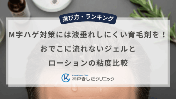 M字ハゲ対策には液垂れしにくい育毛剤を！おでこに流れないジェルとローションの粘度比較