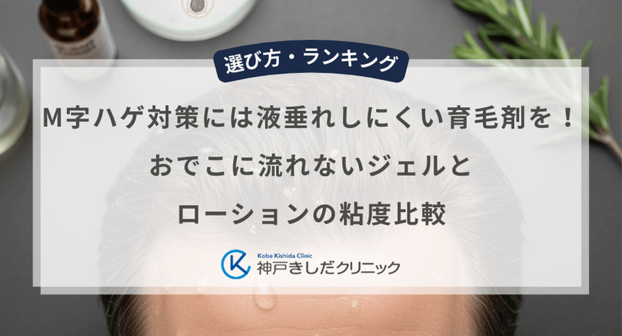 M字ハゲ対策には液垂れしにくい育毛剤を！おでこに流れないジェルとローションの粘度比較