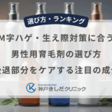 M字ハゲ・生え際対策に合う男性用育毛剤の選び方｜後退部分をケアする注目の成分
