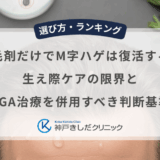 育毛剤だけでM字ハゲは復活する？生え際ケアの限界とAGA治療を併用すべき判断基準
