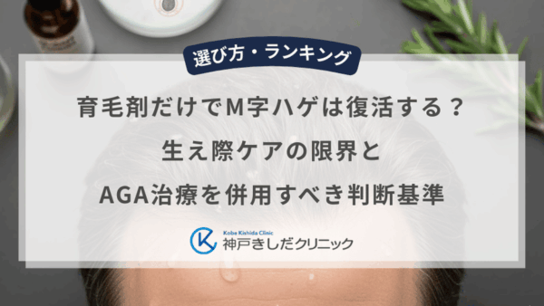 育毛剤だけでM字ハゲは復活する？生え際ケアの限界とAGA治療を併用すべき判断基準