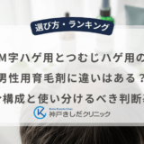 M字ハゲ用とつむじハゲ用の男性用育毛剤に違いはある？成分構成と使い分けるべき判断基準