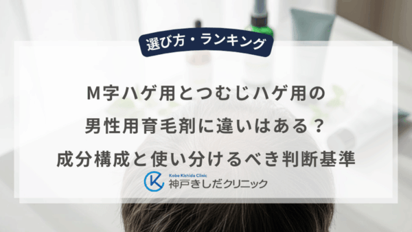 M字ハゲ用とつむじハゲ用の男性用育毛剤に違いはある？成分構成と使い分けるべき判断基準