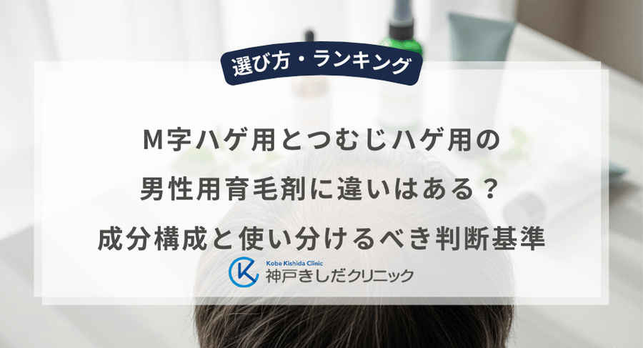 M字ハゲ用とつむじハゲ用の男性用育毛剤に違いはある?成分構成と使い分けるべき判断基準
