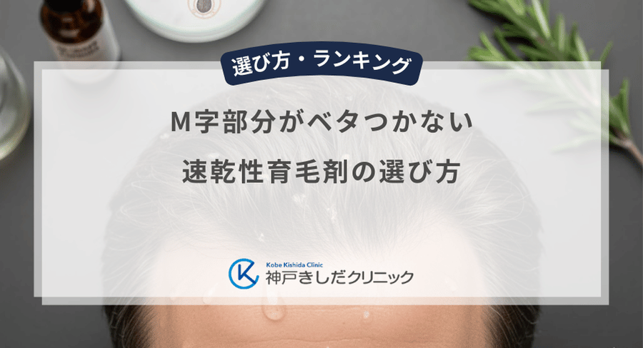 M字部分がベタつかない速乾性育毛剤の選び方|前髪のセットを邪魔しない男性用商品の基準