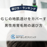 つむじの地肌透けをカバーする男性用育毛剤の選び方｜髪にハリを出してボリュームアップする成分
