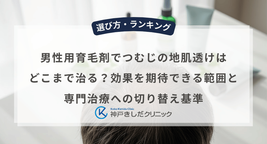 男性用育毛剤でつむじの地肌透けはどこまで治る?効果を期待できる範囲と専門治療への切り替え基準