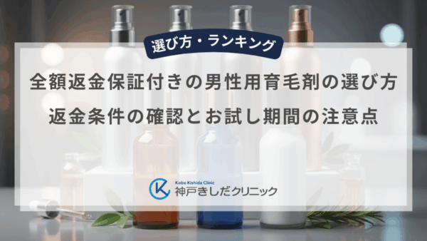 全額返金保証付きの男性用育毛剤の選び方｜返金条件の確認とお試し期間の注意点