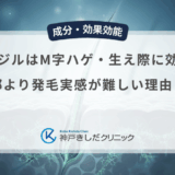 ミノキシジルはM字ハゲ・生え際に効かない？頭頂部より発毛実感が難しい理由と対策