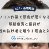 パソコン作業で頭皮が硬くなる？眼精疲労と猫背が男性の抜け毛を増やす理由と対策