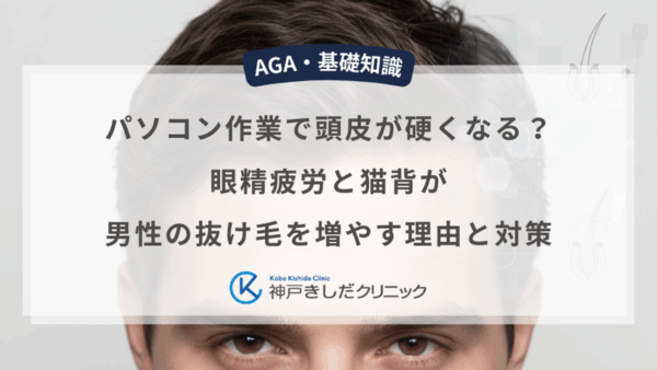 パソコン作業で頭皮が硬くなる？眼精疲労と猫背が男性の抜け毛を増やす理由と対策