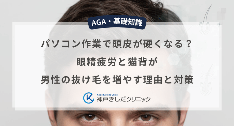 パソコン作業で頭皮が硬くなる？眼精疲労と猫背が男性の抜け毛を増やす理由と対策