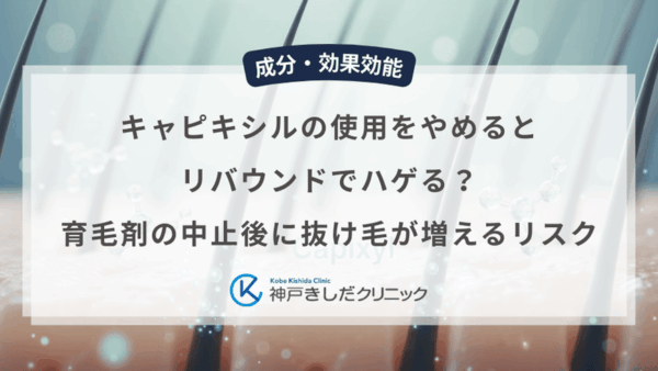 キャピキシルの使用をやめるとリバウンドでハゲる？育毛剤の中止後に抜け毛が増えるリスク