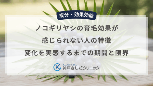 ノコギリヤシの育毛効果が感じられない人の特徴｜変化を実感するまでの期間と限界