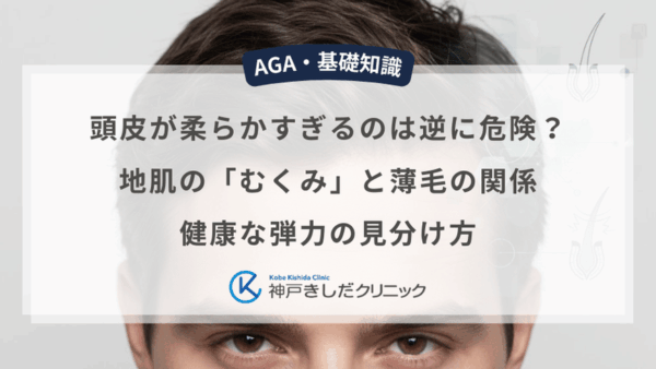 頭皮が柔らかすぎるのは逆に危険？地肌の「むくみ」と薄毛の関係｜健康な弾力の見分け方