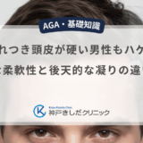 生まれつき頭皮が硬い男性もハゲる？遺伝的な柔軟性と後天的な凝りの違いを比較