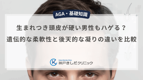 生まれつき頭皮が硬い男性もハゲる？遺伝的な柔軟性と後天的な凝りの違いを比較