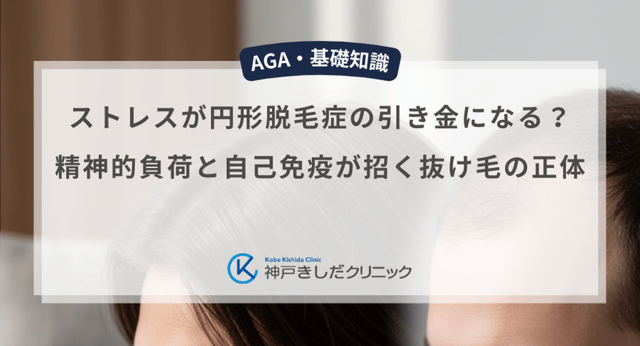ストレスが円形脱毛症の引き金になる？精神的負荷と自己免疫が招く抜け毛の正体