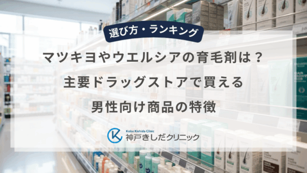マツキヨやウエルシアの育毛剤は？主要ドラッグストアで買える男性向け商品の特徴