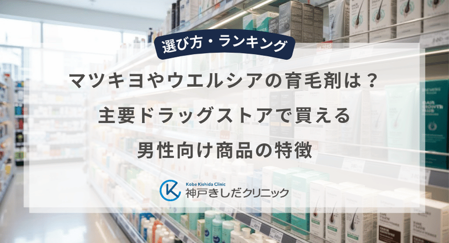 マツキヨやウエルシアの育毛剤は？主要ドラッグストアで買える男性向け商品の特徴