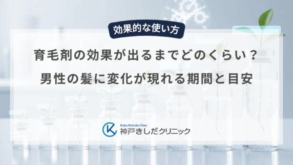 育毛剤の効果が出るまでどのくらい？男性の髪に変化が現れる期間と目安