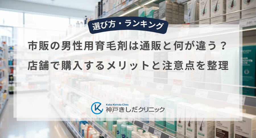 市販の男性用育毛剤は通販と何が違う?店舗で購入するメリットと注意点を整理