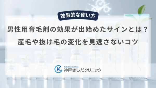 男性用育毛剤の効果が出始めたサインとは？産毛や抜け毛の変化を見逃さないコツ