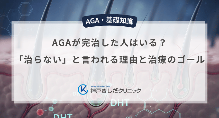 AGAが完治した人はいる？「治らない」と言われる理由と治療のゴール