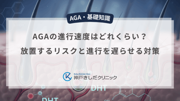 AGAの進行速度はどれくらい？放置するリスクと進行を遅らせる対策