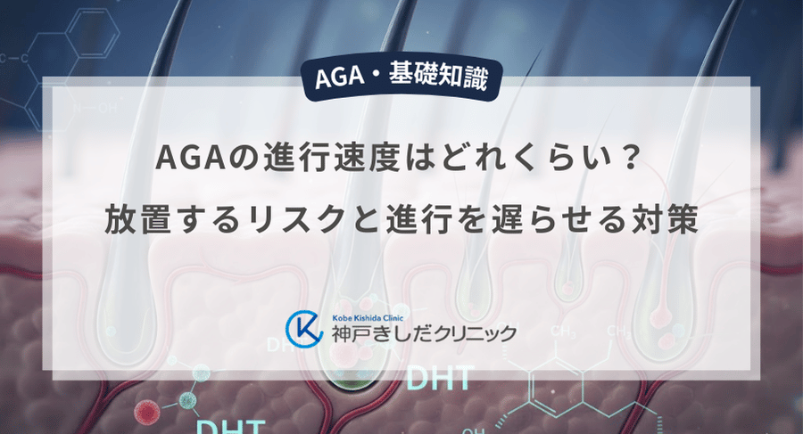 AGAの進行速度はどれくらい？放置するリスクと進行を遅らせる対策