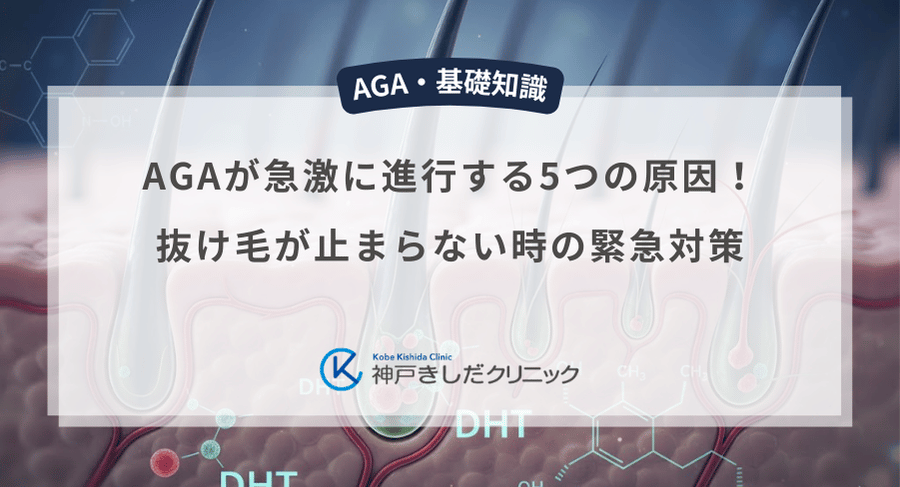 AGAが急激に進行する5つの原因!抜け毛が止まらない時の緊急対策