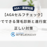 【AGAセルフチェック】自分でできる薄毛診断と進行度別の正しい対策