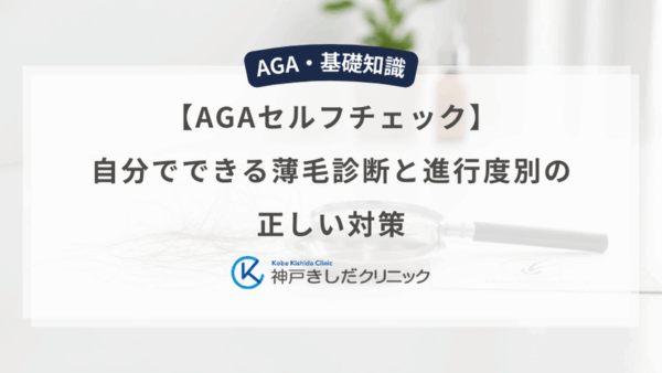 【AGAセルフチェック】自分でできる薄毛診断と進行度別の正しい対策