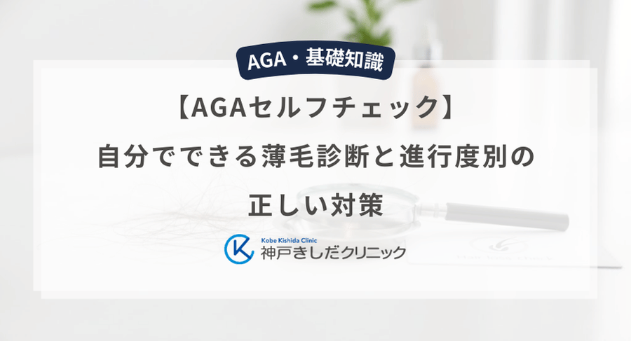 【AGAセルフチェック】自分でできる薄毛診断と進行度別の正しい対策