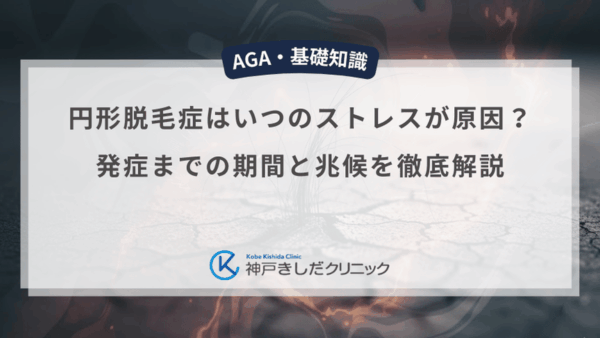 円形脱毛症はいつのストレスが原因？発症までの期間と兆候を徹底解説