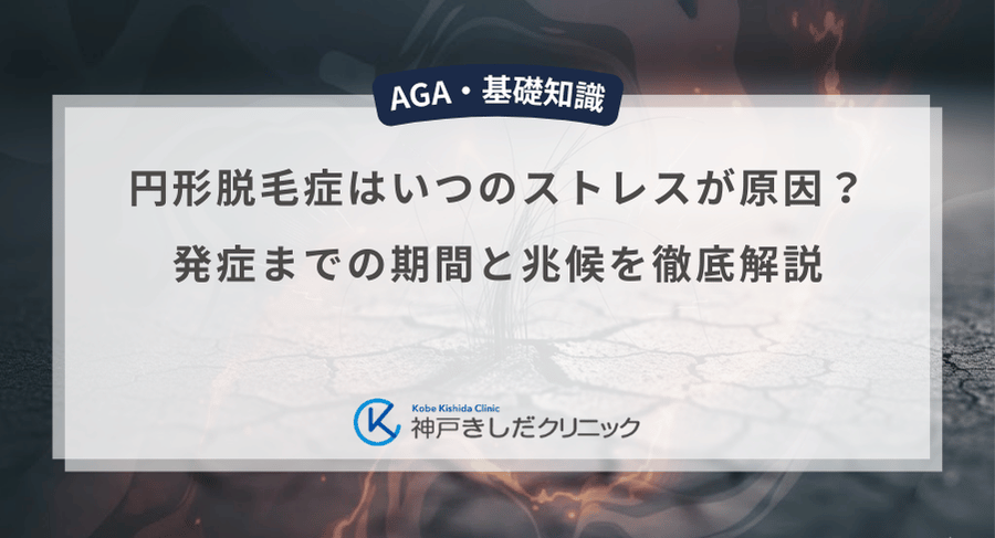 円形脱毛症はいつのストレスが原因？発症までの期間と兆候を徹底解説