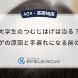 大学生のつむじはげは治る？若ハゲの原因と手遅れになる前の対策