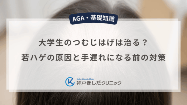 大学生のつむじはげは治る？若ハゲの原因と手遅れになる前の対策