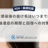 コロナ感染後の抜け毛はいつまで続く？後遺症の期間と回復への対策