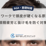 デスクワークで頭皮が硬くなる原因は？眼精疲労と抜け毛を防ぐ対策