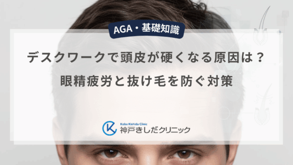 デスクワークで頭皮が硬くなる原因は？眼精疲労と抜け毛を防ぐ対策
