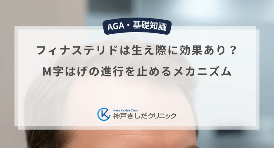 フィナステリドは生え際に効果あり？M字はげの進行を止めるメカニズム