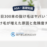 1日300本の抜け毛はヤバい？急に抜け毛が増えた原因と危険度チェック