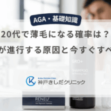 20代で薄毛になる確率は？若ハゲが進行する原因と今すぐすべき対策