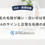 抜け毛の毛根が細い・白いのは危険？AGAのサインと正常な毛根の違い