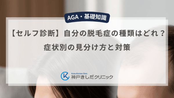 【セルフ診断】自分の脱毛症の種類はどれ？症状別の見分け方と対策